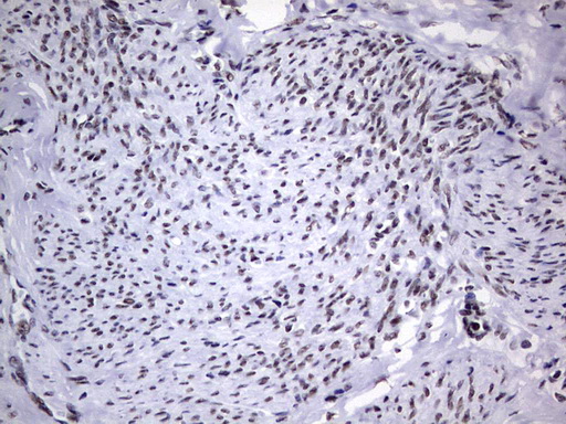 m05396 anti nipp1 ppp1r8 mouse monoclonal antibody clone id oti4e5 ihc testing 9