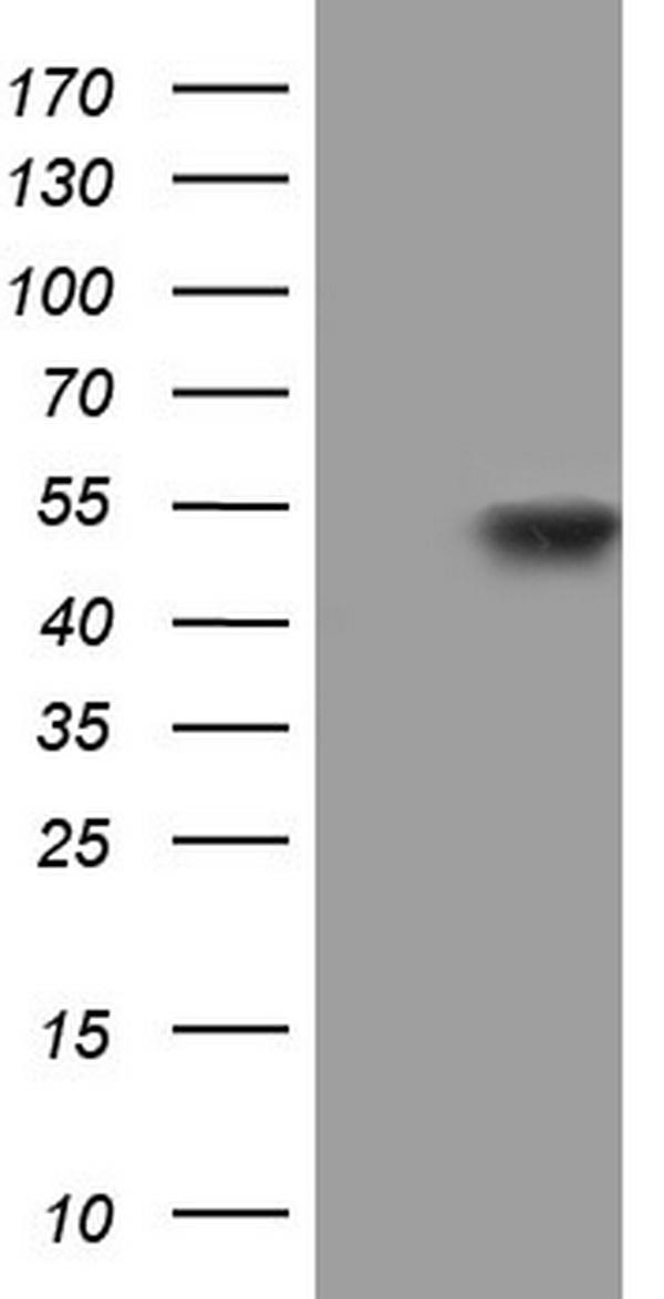 HEK293T cells were transfected with the pCMV6-ENTRY control (Left lane) or pCMV6-ENTRY PPP1R8 (Right lane) cDNA for 48 hrs and lysed