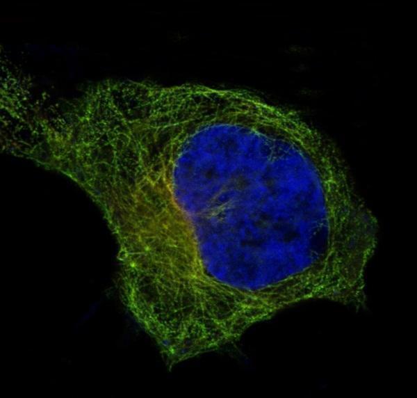 IF analysis of immunocytochemical section of Hela cells using anti-beta I Tubulin antibody (M05397)  beta I Tubulin was detected in immunocytochemical section
