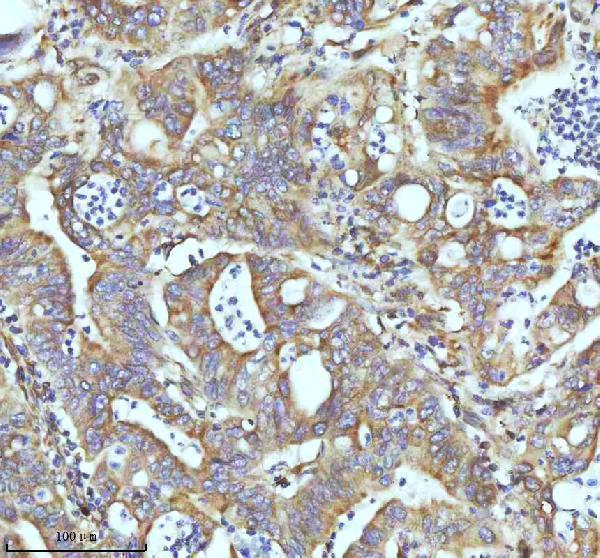 m05397 tubb1 primary antibodies ihc testing 11