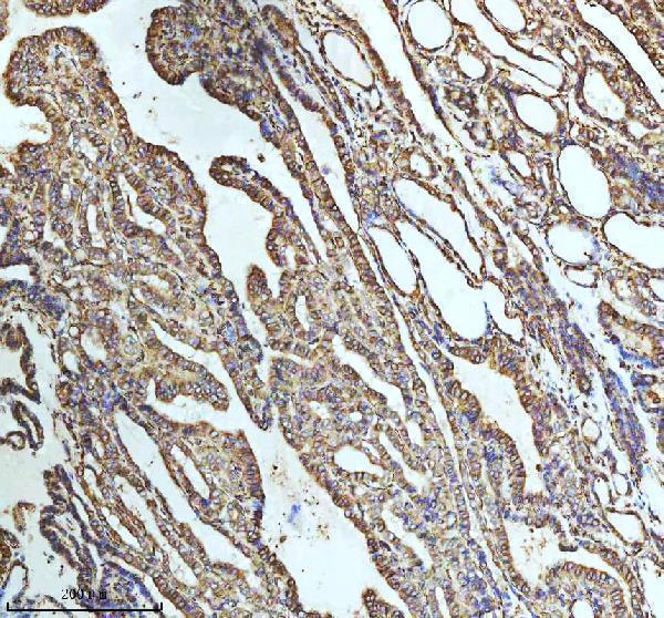 m05397 tubb1 primary antibodies ihc testing 12