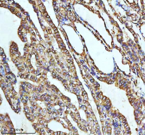 m05397 tubb1 primary antibodies ihc testing 13