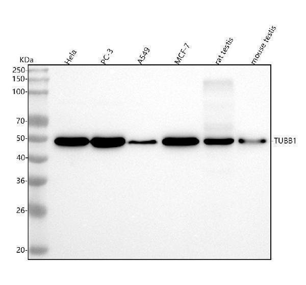  Western blot analysis of TUBB1 using anti-TUBB1 antibody (M05397)