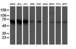 Western blot analysis of extracts (35ug) from 9 different cell lines by using anti-ATIC monoclonal antibody