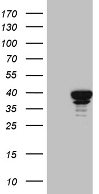 HEK293T cells were transfected with the pCMV6-ENTRY control (Left lane) or pCMV6-ENTRY SUGT1 (Right lane) cDNA for 48 hrs and lysed