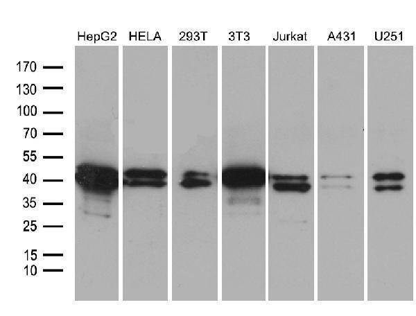 Western blot analysis of extracts (35ug) from 7 different cell lines by using anti-SUGT1 monoclonal antibody (1:500)