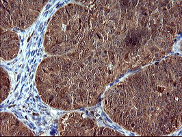 m05419 anti siva siva1 mouse monoclonal antibody clone id oti2f8 ihc testing 2
