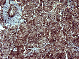 m05419 anti siva siva1 mouse monoclonal antibody clone id oti2f8 ihc testing 3