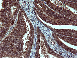 m05419 anti siva siva1 mouse monoclonal antibody clone id oti2f8 ihc testing 5
