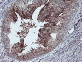 m05421 1 anti cralbp rlbp1 mouse monoclonal antibody clone id oti1g6 ihc testing 3