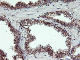 m05421 1 anti cralbp rlbp1 mouse monoclonal antibody clone id oti1g6 ihc testing 4