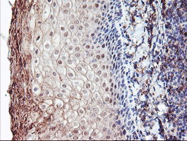 m05421 1 anti cralbp rlbp1 mouse monoclonal antibody clone id oti1g6 ihc testing 5