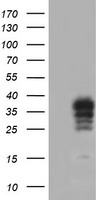 m05421 1 anti cralbp rlbp1 mouse monoclonal antibody clone id oti1g6 wb testing 1