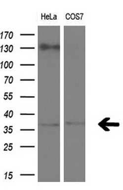 m05421 1 anti cralbp rlbp1 mouse monoclonal antibody clone id oti1g6 wb testing 2