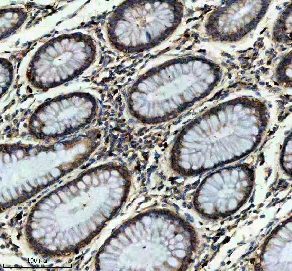 m05433 itgb7 primary antibodies ihc testing 1