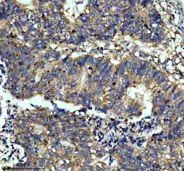 m05433 itgb7 primary antibodies ihc testing 2