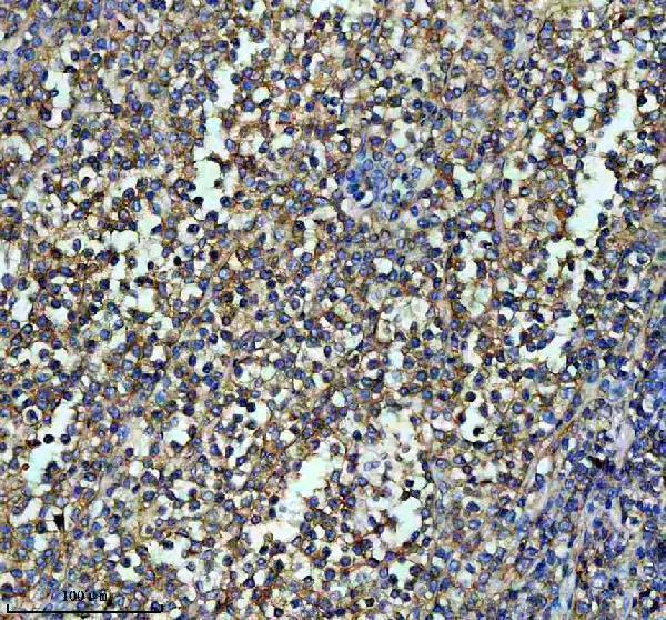 IHC analysis of ITGB7 using anti-ITGB7 antibody (M05433)