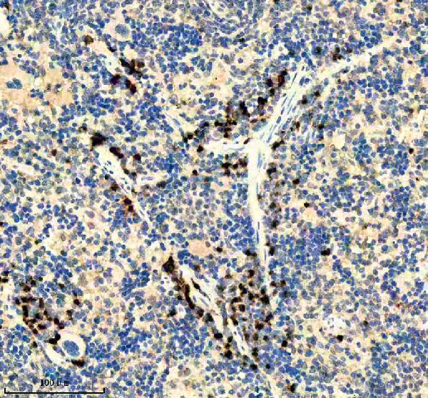 IHC analysis of ITGB7 using anti-ITGB7 antibody (M05433)