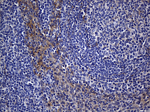 Immunohistochemical staining of paraffin-embedded Human tonsil within the normal limits using anti-WASL mouse monoclonal antibody