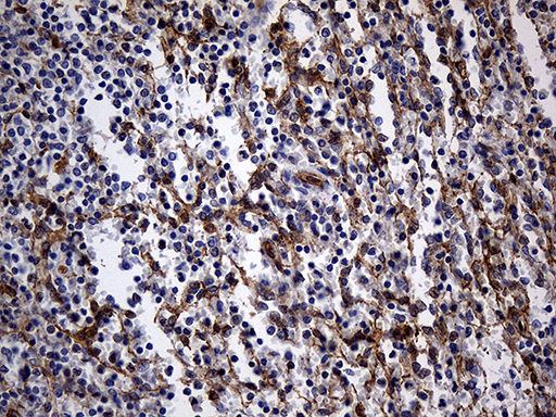 Immunohistochemical staining of paraffin-embedded Human spleen tissue within the normal limits using anti-WASL mouse monoclonal antibody
