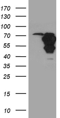 HEK293T cells were transfected with the pCMV6-ENTRY control (Left lane) or pCMV6-ENTRY WASL (Right lane) cDNA for 48 hrs and lysed