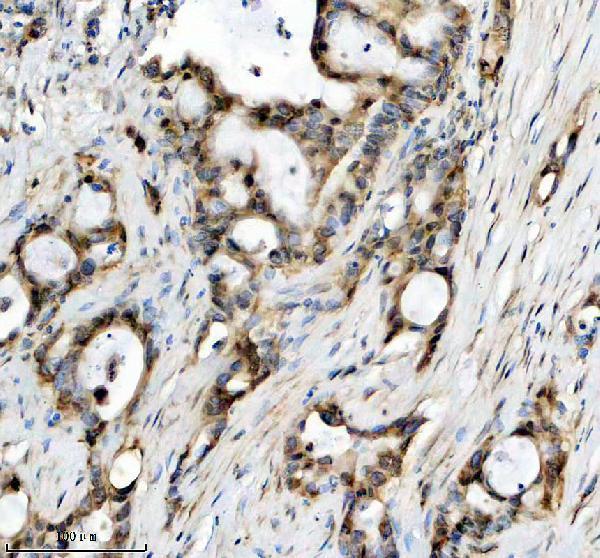 m05438 wasl primary antibodies ihc testing 1