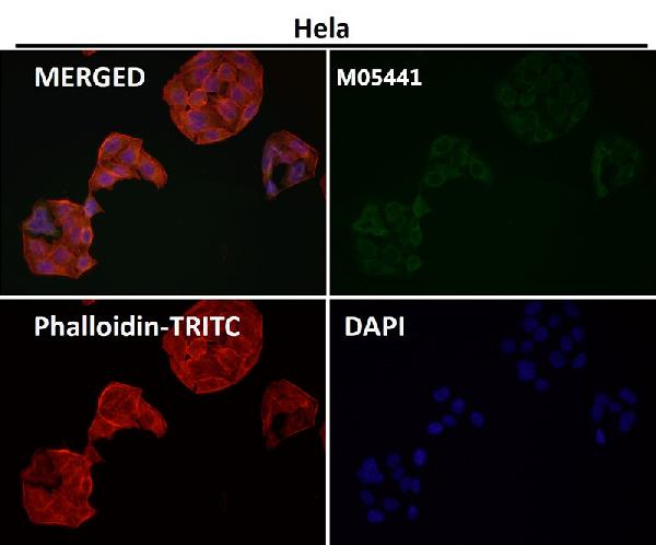 Immunofluorescent analysis using the Antibody at 1:50 dilution.