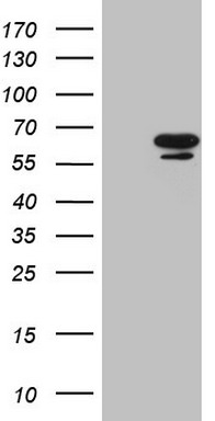 HEK293T cells were transfected with the pCMV6-ENTRY control (Left lane) or pCMV6-ENTRY NR6A1 (Right lane) cDNA for 48 hrs and lysed