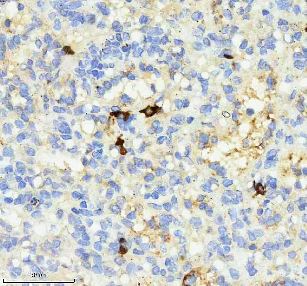IHC analysis of ig Kappa light chain using anti-ig Kappa light chain antibody (M05470-1)