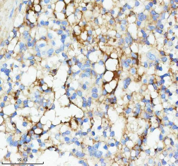 IHC analysis of ig Kappa light chain using anti-ig Kappa light chain antibody (M05470-1)