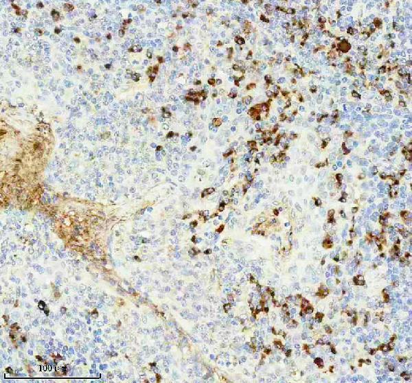 m05470 1 igkc primary antibodies ihc testing 3