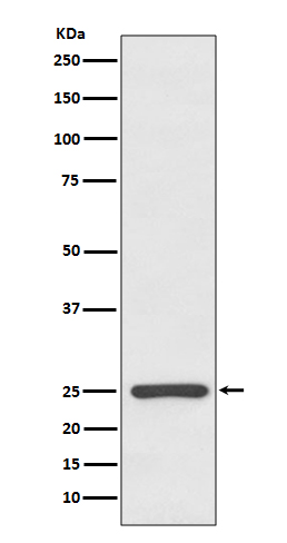 Western blot analysis of Kappa light chain expression in human plasma lysate