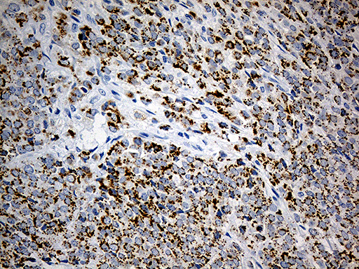 m05479 anti lsdp5 plin5 mouse monoclonal antibody clone id oti3f2 ihc testing 2