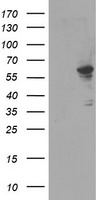 HEK293T cells were transfected with the pCMV6-ENTRY control (Left lane) or pCMV6-ENTRY FTCD (Right lane) cDNA for 48 hrs and lysed