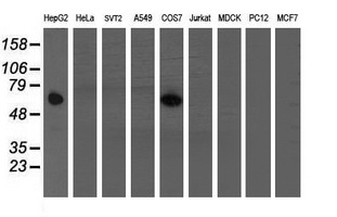 Western blot analysis of extracts (35ug) from 9 different cell lines by using anti-FTCD monoclonal antibody (HepG2: human; HeLa: human; SVT2: mouse; A549: human; COS7: monkey; Jurkat: human; MDCK: canine; PC12: rat; MCF7: human)
