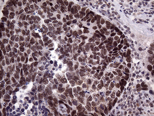 m05503 anti lhx4 mouse monoclonal antibody clone id oti1c7 ihc testing 2