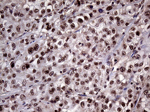 m05503 anti lhx4 mouse monoclonal antibody clone id oti1c7 ihc testing 3