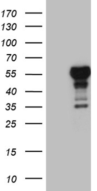 m05503 anti lhx4 mouse monoclonal antibody clone id oti1c7 wb testing 1