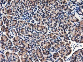 Immunohistochemical staining of paraffin-embedded Human pancreas tissue within the normal limits using anti-HMOX2 mouse monoclonal antibody