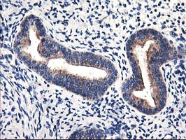 Immunohistochemical staining of paraffin-embedded Human endometrium tissue within the normal limits using anti-HMOX2 mouse monoclonal antibody