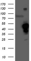HEK293T cells were transfected with the pCMV6-ENTRY control (Left lane) or pCMV6-ENTRY HMOX2 (Right lane) cDNA for 48 hrs and lysed