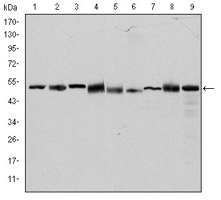 Western blotting validation for Anti-TCP-1 beta CCT2 Monoclonal Antibody M05524-1
Western Blot (WB) analysis using TCP-1 beta Monoclonal Antibody against HeLa (1)