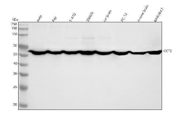  Western blot analysis of TCP1 Beta using anti-TCP1 Beta antibody (M05524-2)
