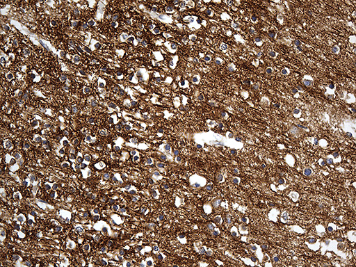 Immunohistochemical staining of paraffin-embedded Human adult brain tissue within the normal limits using anti-DBN1 mouse monoclonal antibody