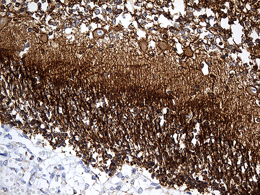 m05530 3 anti drebrin dbn1 mouse monoclonal antibody clone id oti4g4 ihc testing 4