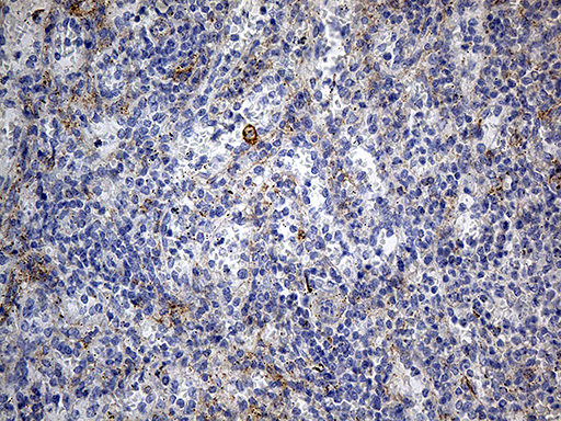 m05530 3 anti drebrin dbn1 mouse monoclonal antibody clone id oti4g4 ihc testing 5