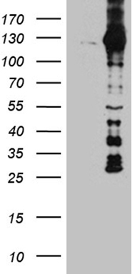 HEK293T cells were transfected with the pCMV6-ENTRY control (Left lane) or pCMV6-ENTRY DBN1 (Right lane) cDNA for 48 hrs and lysed