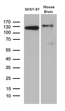 Western blot analysis of extracts (35ug) from SHSY-5Y cell line and mouse brain tissue lysate by using anti-DBN1 monoclonal antibody (1:500)