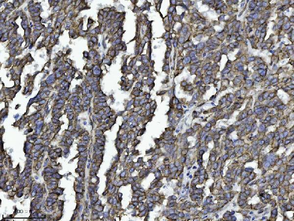  IHC analysis of DBN1 using anti-DBN1 antibody (M05530-4)