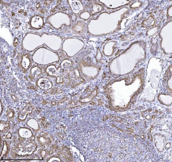  IHC analysis of DBN1 using anti-DBN1 antibody (M05530-4)